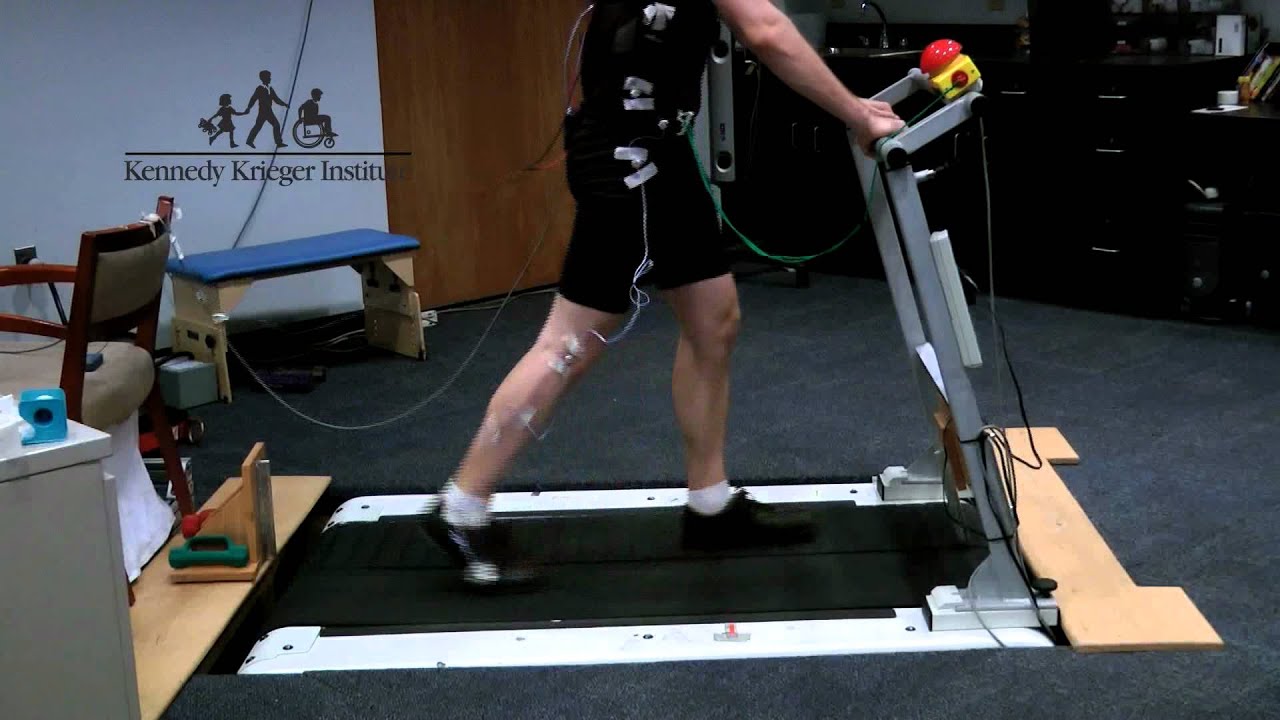 Walking Two Ways at Once A research study experience on a split belt treadmill